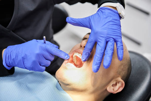 Best Urgent Care for Lost Fillings or Crowns in Murphy, NC